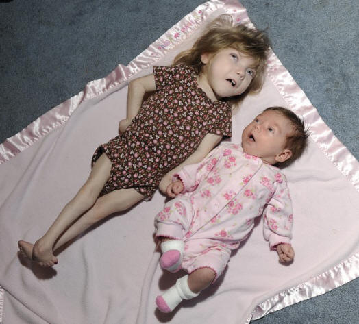 Osmogodišnja djevojčica s bebinim tijelom čuva tajnu vječne mladosti