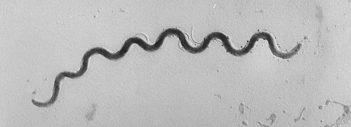 Amerika mora biti odgovorna za infekciju gvatemalskog sifilisa