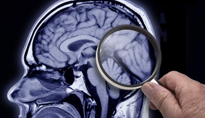 Amerikanci će uskoro početi podizati mrtve.