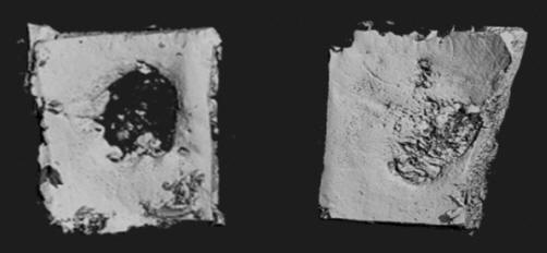 potencijalne upotrebe-za-zubne-od-implantata-do-kraniofacijalnih oštećenja