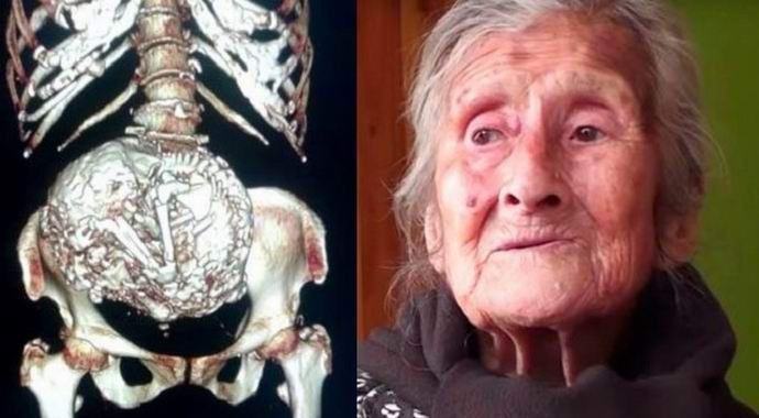 Čileanac je imao dijete šest godina.