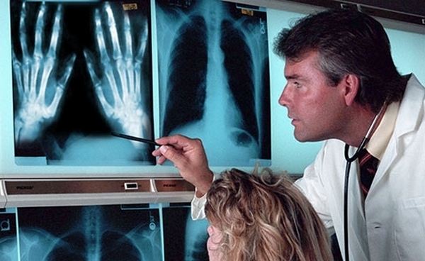 Deset najčudnijih ljudskih bolesti