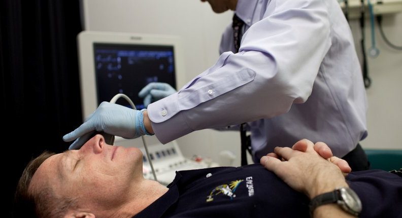 Dugi boravak u svemiru mijenja mozak astronauta 