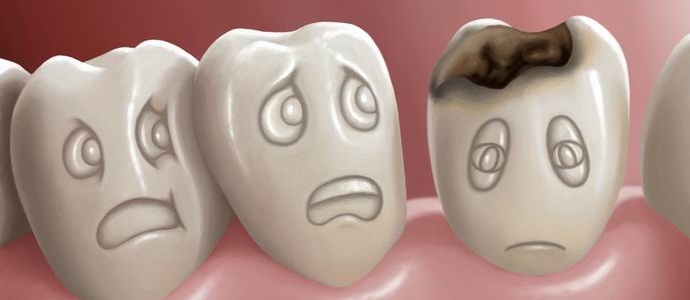 Dvije i pol milijarde zemljaka ne žele liječiti karijes