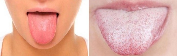 Želite znati svoje zdravlje - pokupite ogledalo