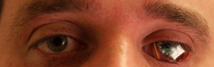 I smislite sve više i savršenije ... štake