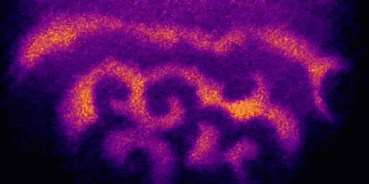 Istraživanje: Život započinje valovima 