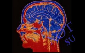 Implantati mozga pomoći će čovjeku da efikasnije radi.