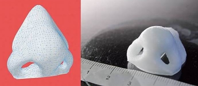 Neobičan štampač stvara proteze iz ljudskog tkiva