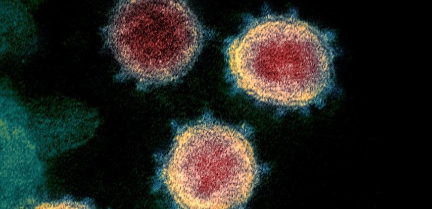 Zdravstvene vlasti očekuju širenje COVID-19 u SAD-u 