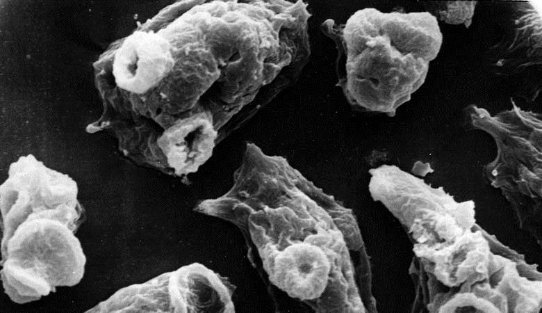 Ameba koja jede mozak donijela je uragan IRMA u SAD