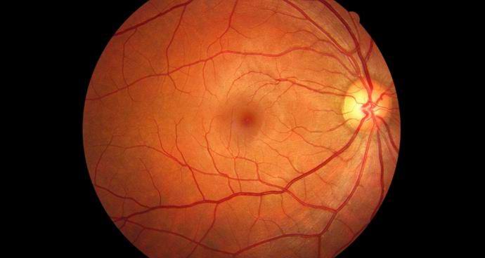 Let do Marsa može astronautima uskratiti vid