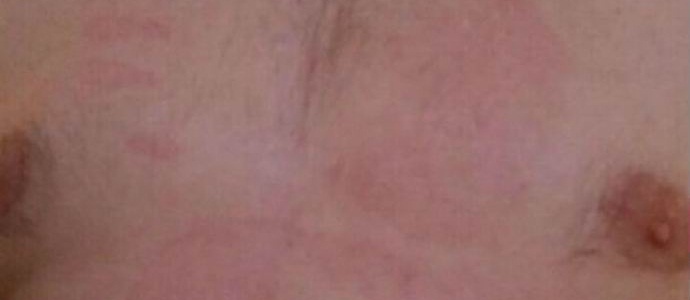 Poltergeistički dlan spalio grudi Novorosijska