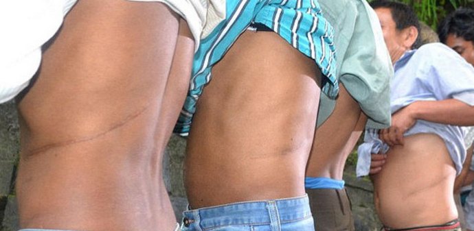 Prodaj bubreg i kupi kuću