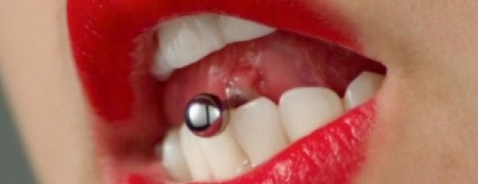 Probio je jezik - izgubio je prednje zube