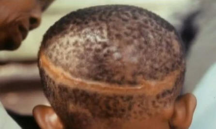 Da li su žigovi povezani sa nasilnom smrću u prošlom životu?