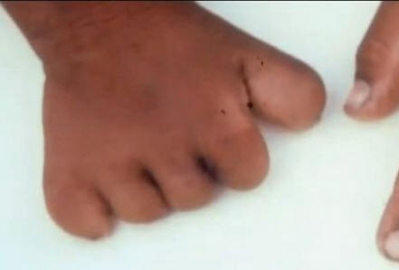 Da li su žigovi povezani sa nasilnom smrću u prošlom životu?