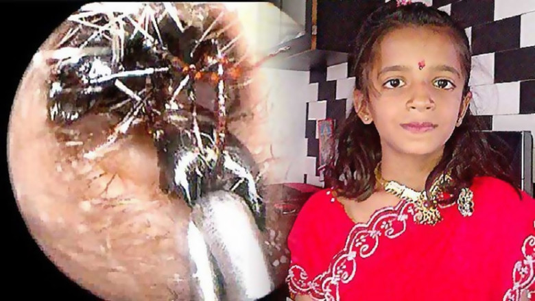 Čudni medicinski slučajevi s mravima u Indiji