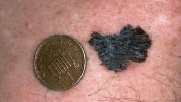 Naučnici su smislili kako