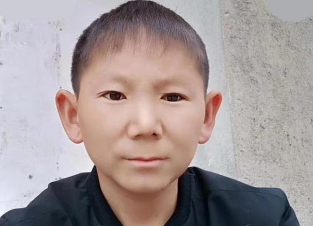 U 34. godini, Kinez izgleda kao šestogodišnjak: nakon što je udario glavu, muškarac je prestao da odrasta.