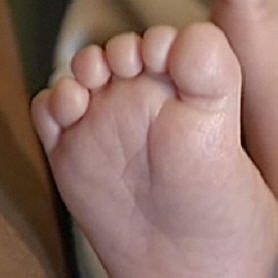 Na području Fukušime raste broj beba sa šest prstiju