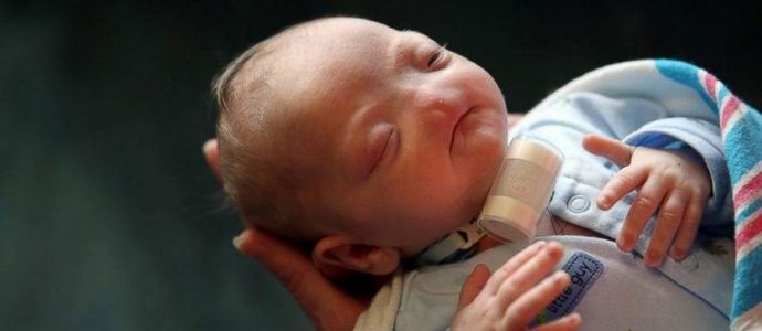 Dijete s rijetkom anomalijom rođeno je u SAD-u