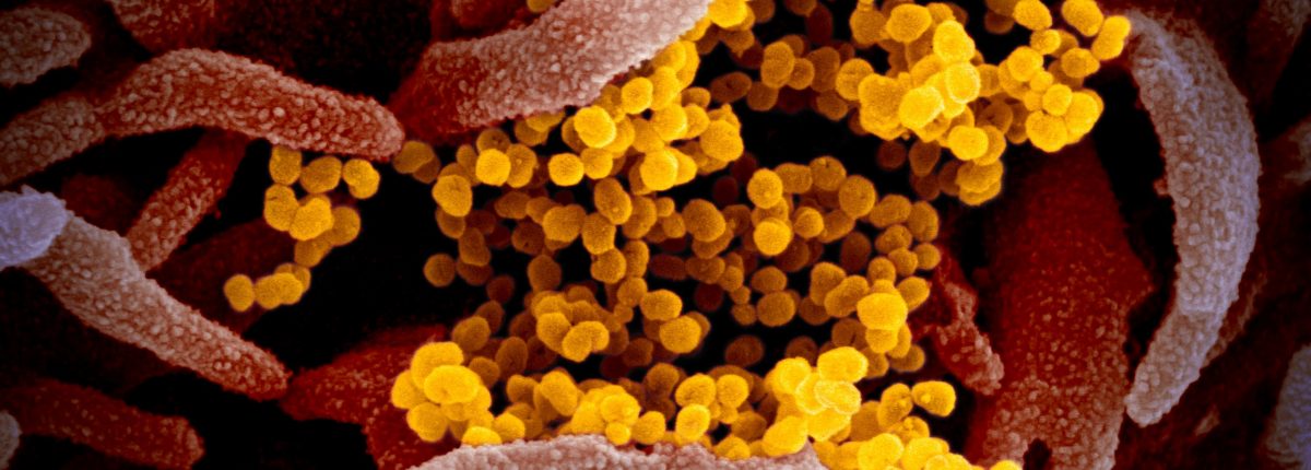 Tako izgleda virus COVID-19 pod mikroskopom 