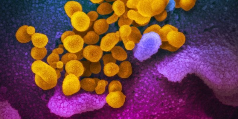 SZO: Najmanje 70 opcija vakcine protiv koronavirusa je već u fazi izrade 