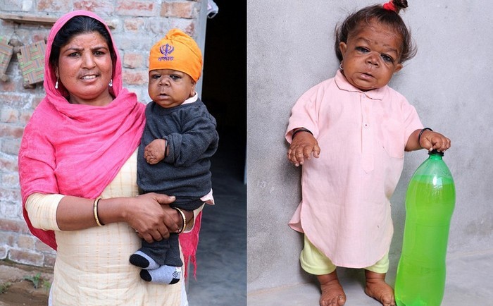 Odrasli Indijanac s tijelom šestomesečne bebe