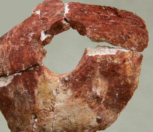 Zašto su pre šest hiljada godina, hirurzi uradili trepanaciju