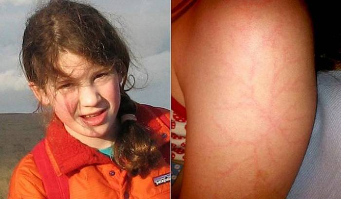 Tajanstveni crteži na koži Rusa